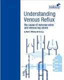 Understanding Venous Reflux The Cause Of Varicose Veins And Venous Leg Ulcers College Of Phlebology Book 1