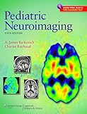 Pediatric Neuroimaging Pediatric Neuroimaging Barkovich English Edition