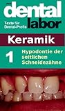 Hypodontie Der Seitlichen Schneidezhne Das Dental Labor Fachtexte 2 German Edition