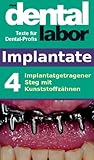 Implantatgetragener Steg Mit Kunststoffzhnen Das Dental Labor Fachtexte 9 German Edition