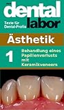Behandlung Eines Papillenverlusts Mit Keramikveneers Das Dental Labor Fachtexte 13 German Edition