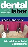 Die Edelmetallfreie Doppelkrone Das Dental Labor Fachtexte 23 German Edition
