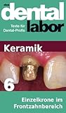 Einzelkrone Im Frontzahnbereich Das Dental Labor Fachtexte 33 German Edition