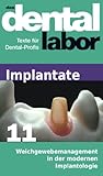 Weichgewebemanagement In Der Modernen Implantologie Das Dental Labor Fachtexte 35 German Edition