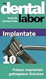 Frsen Implantatgetragener Brcken Das Dental Labor Fachtexte 34 German Edition