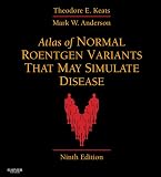 Atlas Of Normal Roentgen Variants That May Simulate Disease Ebook English Edition