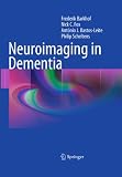 Neuroimaging In Dementia English Edition