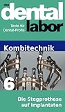 Die Stegprothese Auf Implantaten Das Dental Labor Fachtexte 44 German Edition