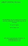 Recubrimiento De Una Estructura De Metal Precioso Utilizando Un Bonderaleacin No Preciosa Labor Dental Tcnica Spanish Edition
