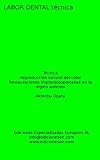 Reproduccin Natural Del Color Restauraciones Implantosoportadas En La Regin Anterior Labor Dental Tcnica Spanish Edition
