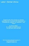 Regeneracin Sea Guiada En Alvolos Postextraccin Secuencia De Tratamiento En Rehabilitacin Superior Con Implantes Caso Clnico Labor Dental Clnica Spanish Edition