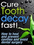 Cure Tooth Decay Fast How To Heal And Prevent Cavities Toothache And Avoid Dental Surgery English Edition