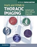 Pearls And Pitfalls In Thoracic Imaging Variants And Other Difficult Diagnoses English Edition