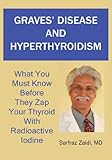 Graves Disease And Hyperthyroidism What You Must Know Before They Zap Your Thyroid With Radioactive Iodine English Edition
