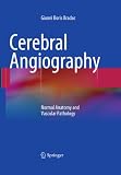 Cerebral Angiography Normal Anatomy And Vascular Pathology