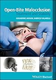 Openbite Malocclusion Treatment And Stability English Edition