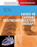 Cases In Cardiac Resynchronization Therapy Ebook English Edition