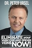 Eliminate Your Varicose And Spider Veins Now English Edition