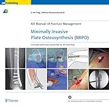 Minimally Invasive Plate Osteosynthesis Mipo Concepts And Cases Presented By The Ao East Asia Ao Copublications English Edition