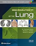 Highresolution Ct Of The Lung English Edition