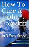 How To Cure A Tight Foreskin In 3 Easy Steps English Edition