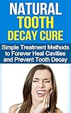 Natural Tooth Decay Cure Simple Treatment Methods To Heal And Prevent Tooth Decay Using Diet And Nutrition Cure Tooth Decay Dental Surgery Tooth Decay And Prevent Tooth Decay English Edition