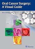 Oral Cancer Surgery A Visual Guide