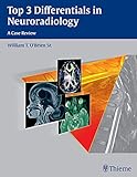 Top 3 Differentials In Neuroradiology English Edition