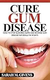 Gum Disease Cure Gum Disease Cure Periodontal Disease Gum Disease Gum Infection Gingivitis Treatment Tooth Decay English Edition