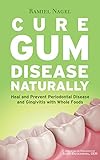 Cure Gum Disease Naturally Heal And Prevent Periodontal Disease And Gingivitis With Whole Foods English Edition