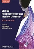 Clinical Periodontology And Implant Dentistry 2 Volume Set English Edition