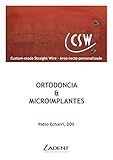 Ortodoncia Microimplantes Spanish Edition