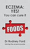 Eczema Yes You Can Cure It Foods The Missing Piece 10 Steps To Solve The Eczema Puzzle English Edition