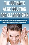 Acne The Ultimate Acne Solution For Clearer Skin Discover Little Known Secrets For Natural Clear Healthy Skin Rid Yourself Of Acne Forever Skin Acne Psoriasis Book 2 English Edition