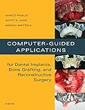Computerguided Dental Implants And Reconstructive Surgery Ebook Clinical Applications English Edition