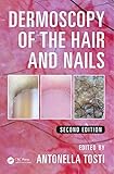 Dermoscopy Of The Hair And Nails English Edition