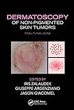 Dermatoscopy Of Nonpigmented Skin Tumors Pink Think Blink English Edition