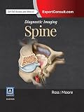 Diagnostic Imaging Spine Ebook English Edition