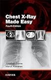 Chest Xray Made Easy Ebook English Edition