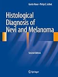 Histological Diagnosis Of Nevi And Melanoma