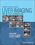 Liver Imaging Mri With Ct Correlation Current Clinical Imaging Book 1 English Edition