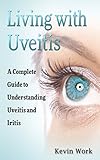 Living With Uveitis A Complete Guide To Uveitis And Iritis