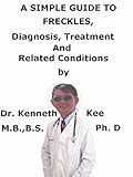 A Simple Guide To Freckles Diagnosis Treatment And Related Conditions A Simple Guide To Medical Conditions English Edition