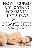 How I Cured My 10 Years Eczema In Just 5 Days With 3 Simple Steps Skin Care Eczema Cure Get Rid Of Eczema Forever Easy And Natural Eczema Treatment Eczema Remedies Stop Eczema Forever