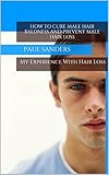 How To Cure Baldness And Prevent Male Hair Loss Mens Hair Loss Propecia Minoxidil Receding Hair Line Hair Regrowth Male Pattern Baldness Mens Hair English Edition
