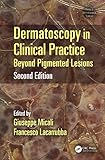Dermatoscopy In Clinical Practice Beyond Pigmented Lesions Series In Dermatological Treatment Book 8 English Edition