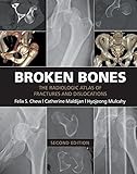 Broken Bones The Radiologic Atlas Of Fractures And Dislocations English Edition