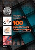 100 Case Reviews In Neurosurgery Ebook English Edition