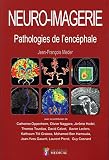 Neuroimagerie Pathologies De Lencphale