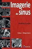 Imagerie Des Sinus